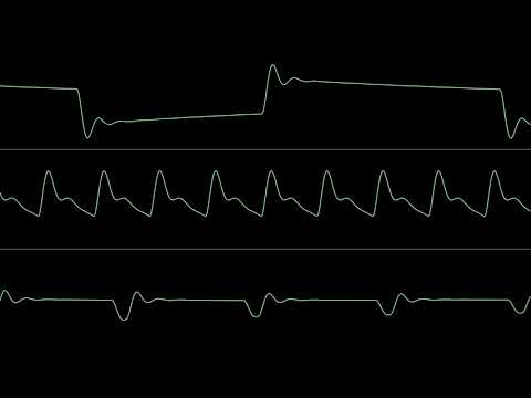 A Mind Is Born by Kryo (lft) 2017 - oscilloscope view of the 256-byte demo showing audio waveforms alongside C64 visual output